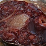 european gross sausage c-section